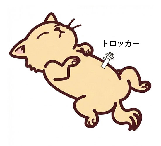 お腹にトロッカーを設置