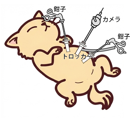 カメラと鉗子で手術を実施